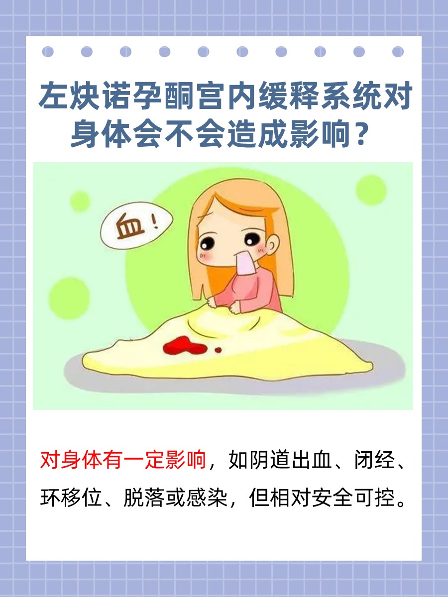 解读：左炔诺孕酮宫内缓释系统对身体有影响吗？