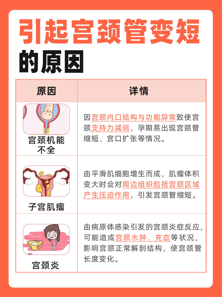 宫颈管长度参照表孕妇