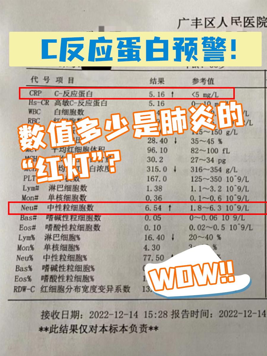 C反应蛋白预警！数值多少是肺炎的“红灯”？