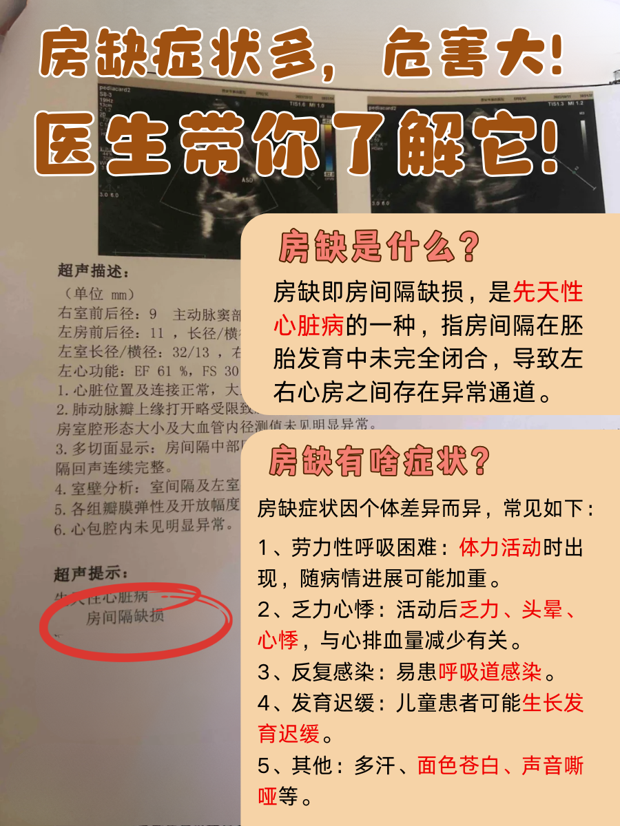 房缺症状多,危害大!医生带你了解它!
