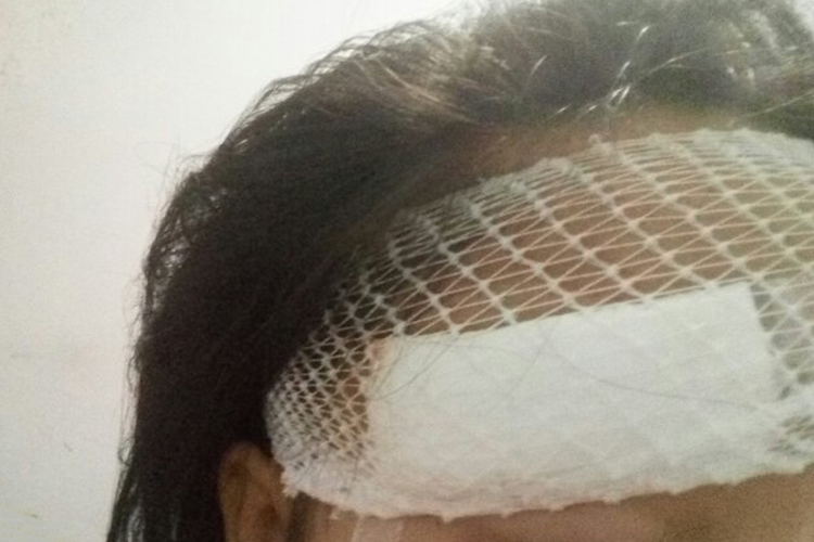 额头缝针尼龙网套包扎图 额头缝针尼龙网套包扎图