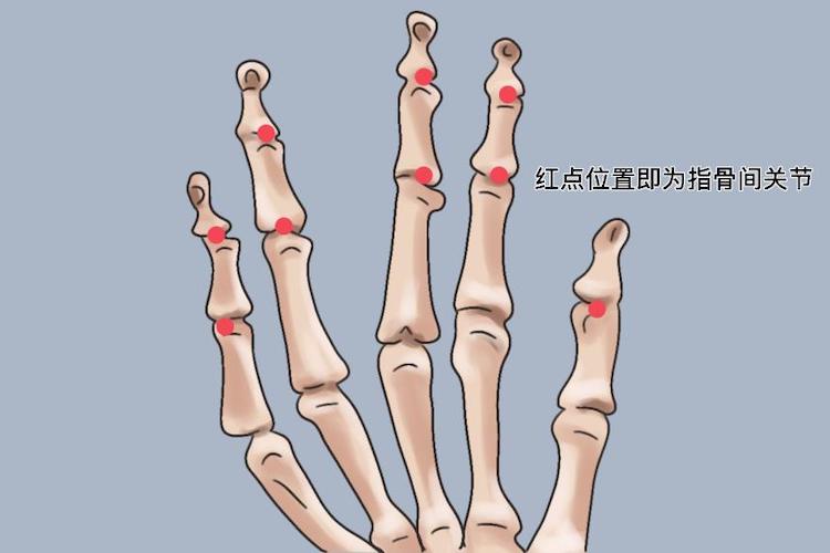 指骨间关节图 指骨间关节图