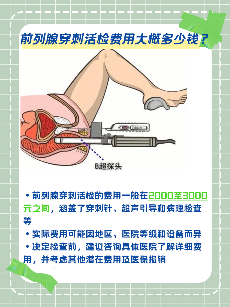 前列腺穿刺活检费用大概多少？了解详细价格信息
