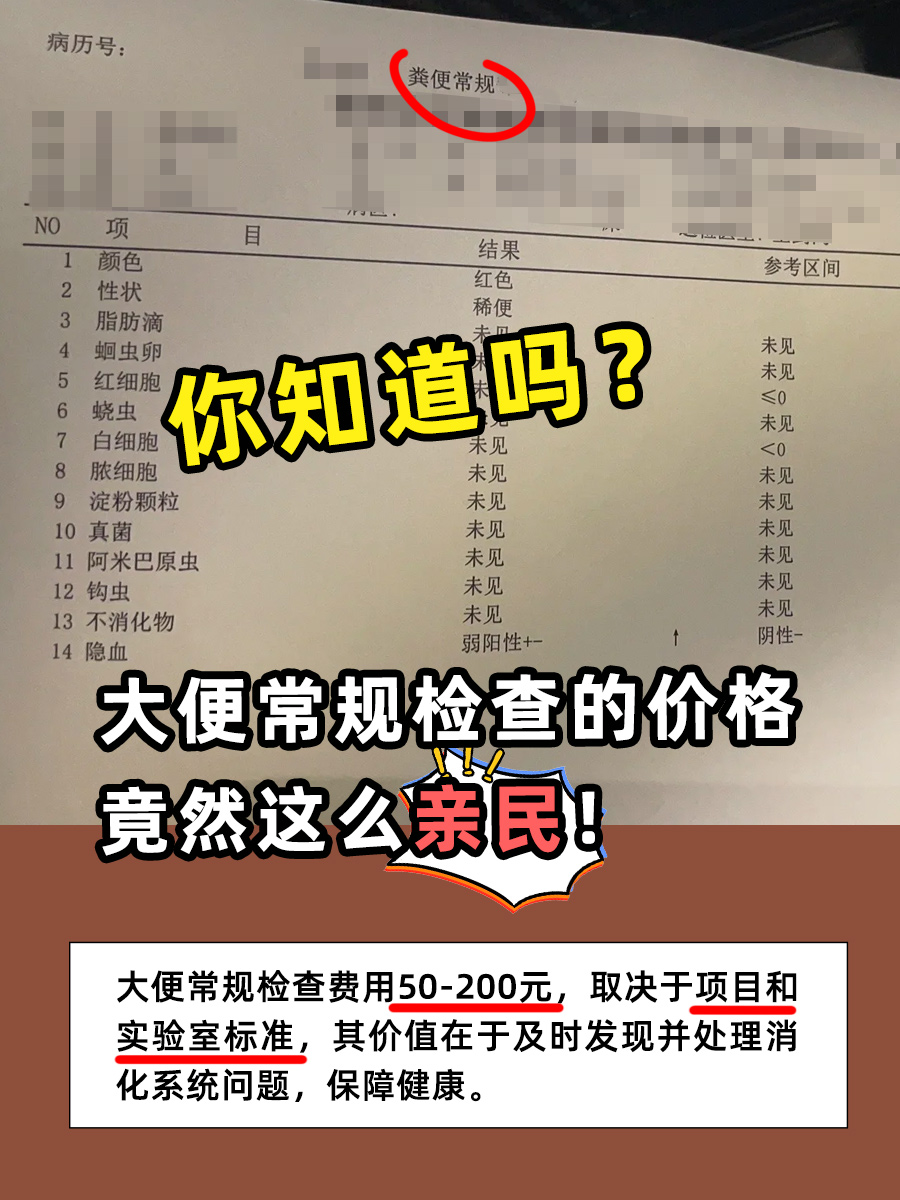 你知道吗？大便常规检查的价格竟然这么亲民！