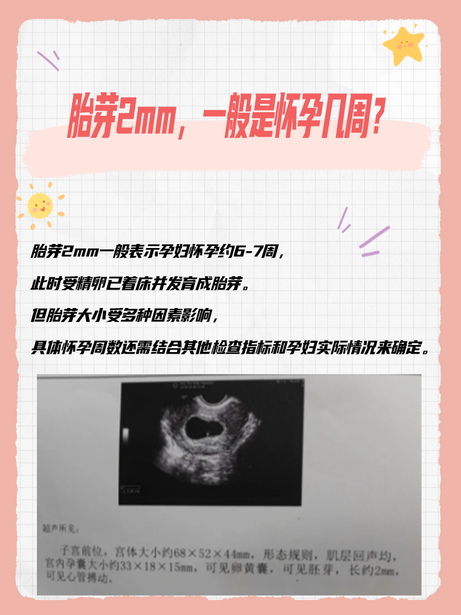 胎芽2mm，一般是怀孕几周？