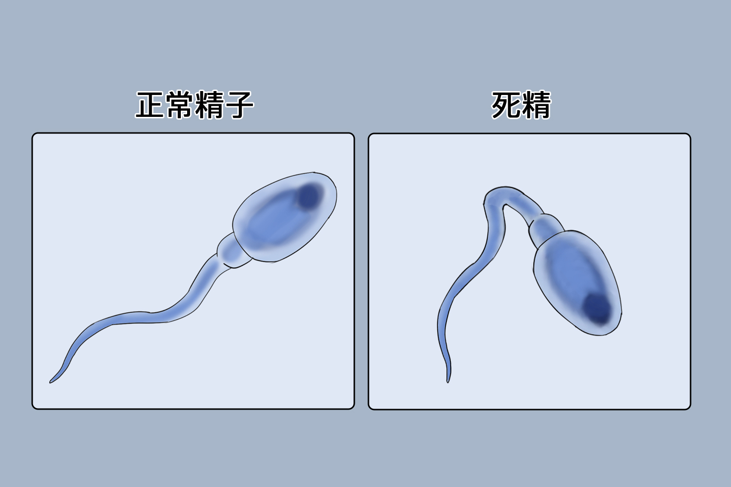 一般情况下活精和死精用显微镜可以分辨,镜下活精是