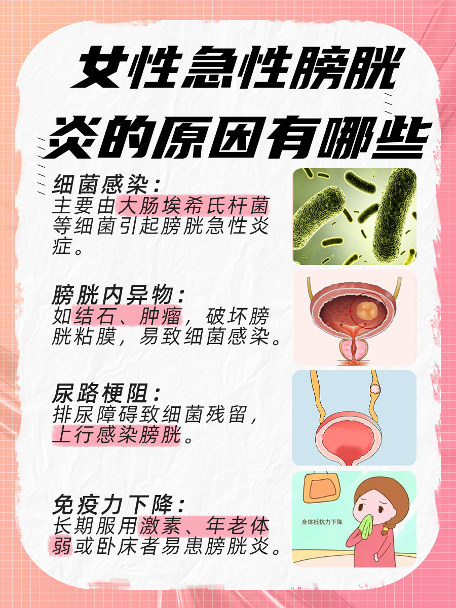 女性急性膀胱炎的原因：这几个你必须知道