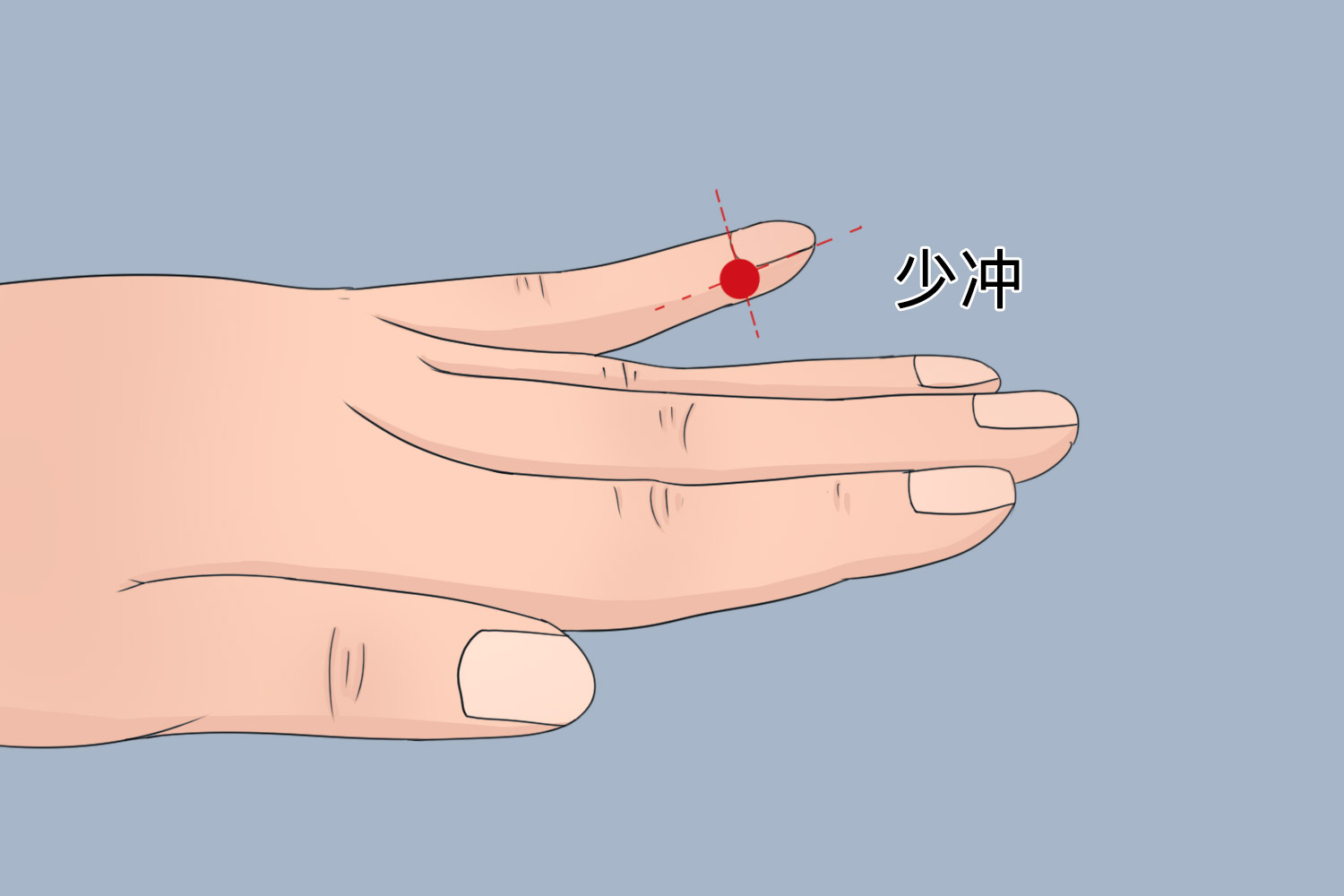 少冲穴位置图 少冲穴位置图