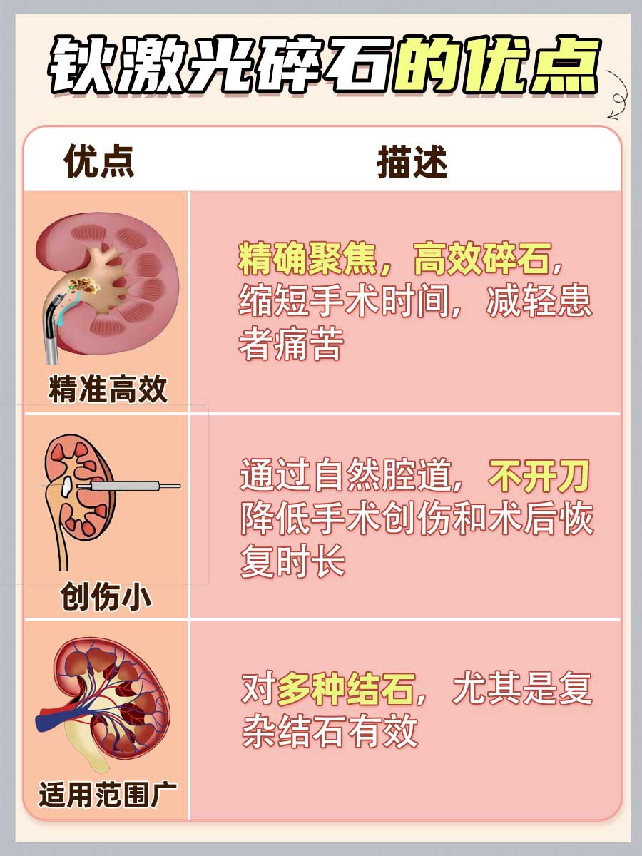 一文解析，钬激光碎石的优缺点