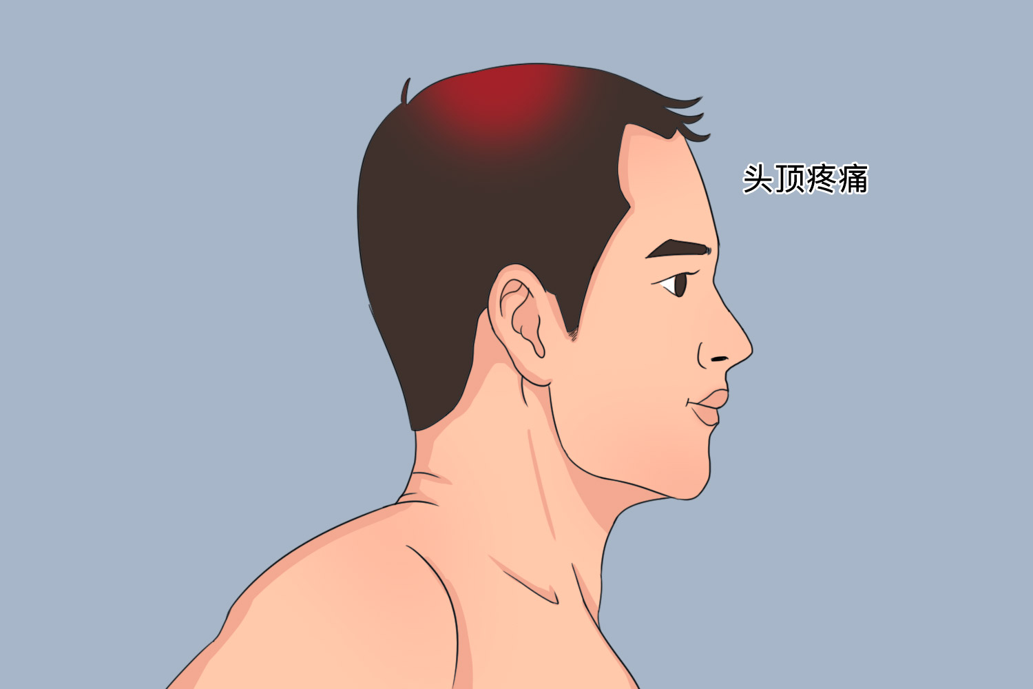 厥阴头痛位置图