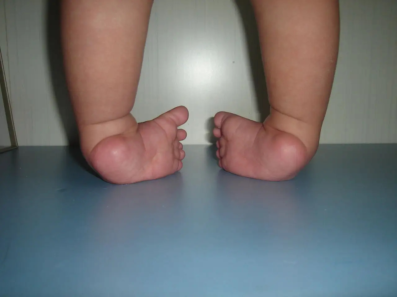 马蹄足图 马蹄足图