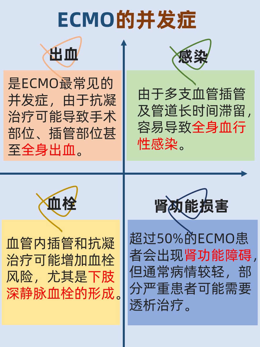 带你认识ECMO：生命线的守护者，不容小觑！