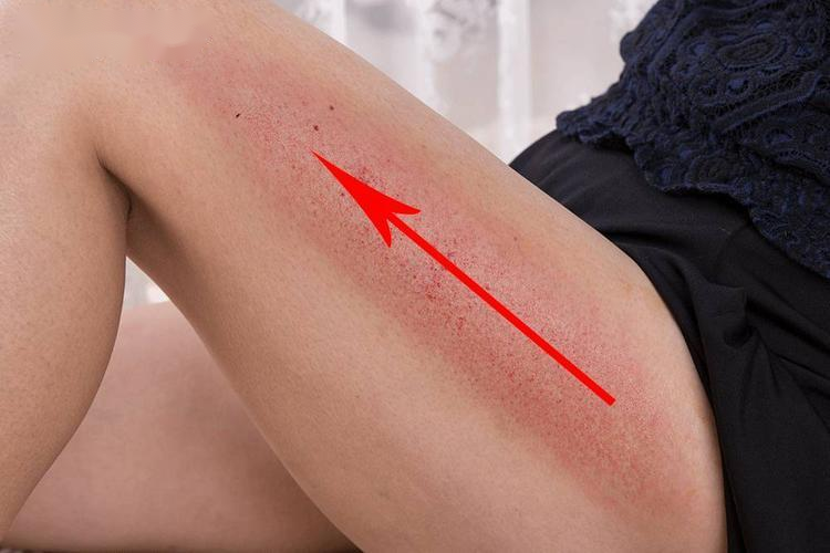 女性腿部走罐图