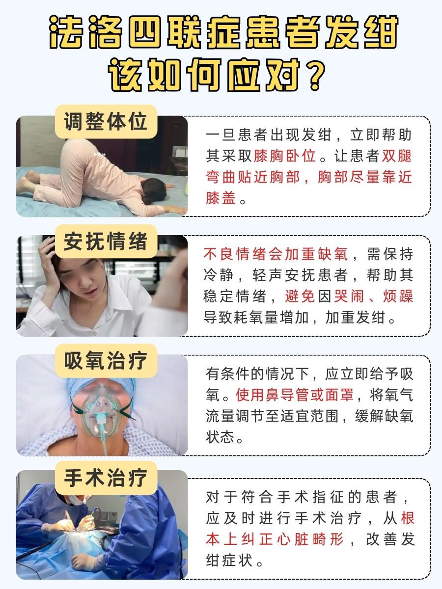 先天性法洛四联症发绀啥表现？速记！