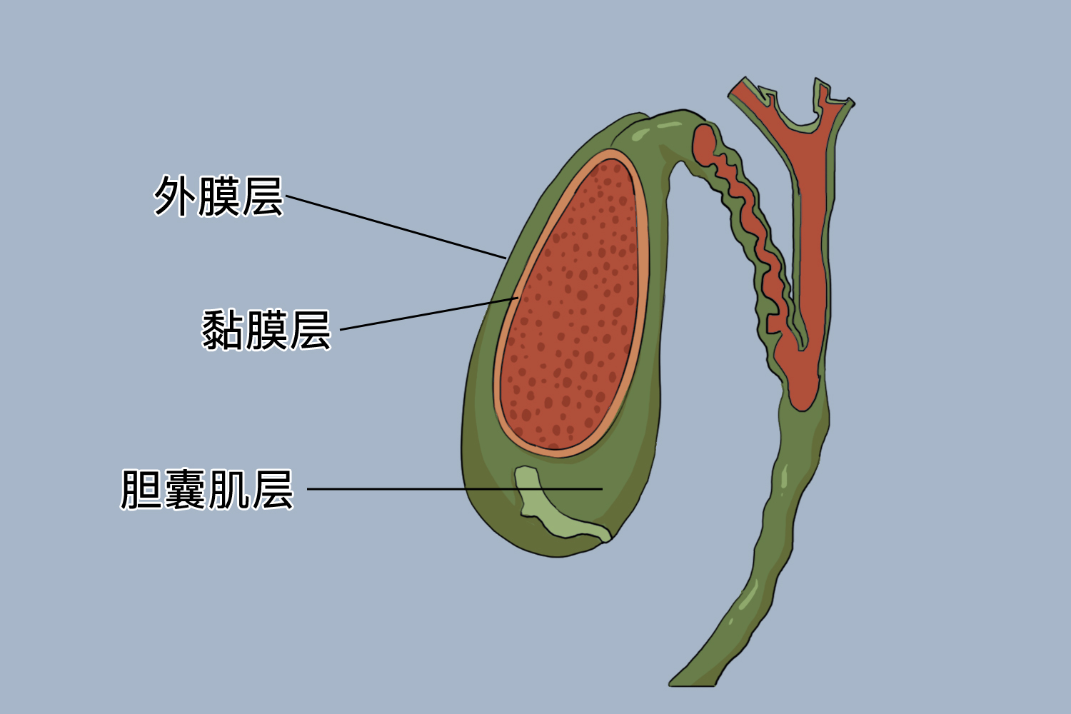 胆囊壁分层示意图