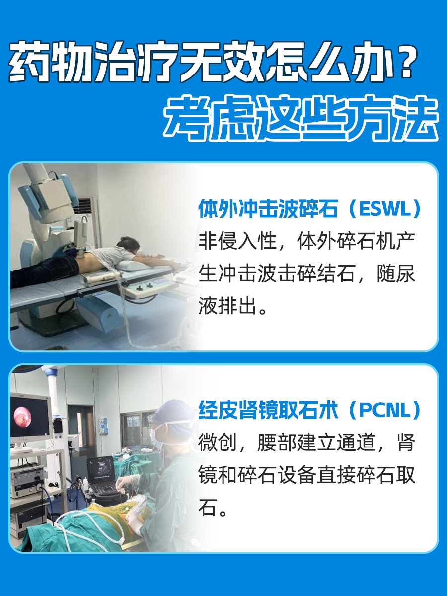 肾结石要吃什么药比较有效,你了解多少?