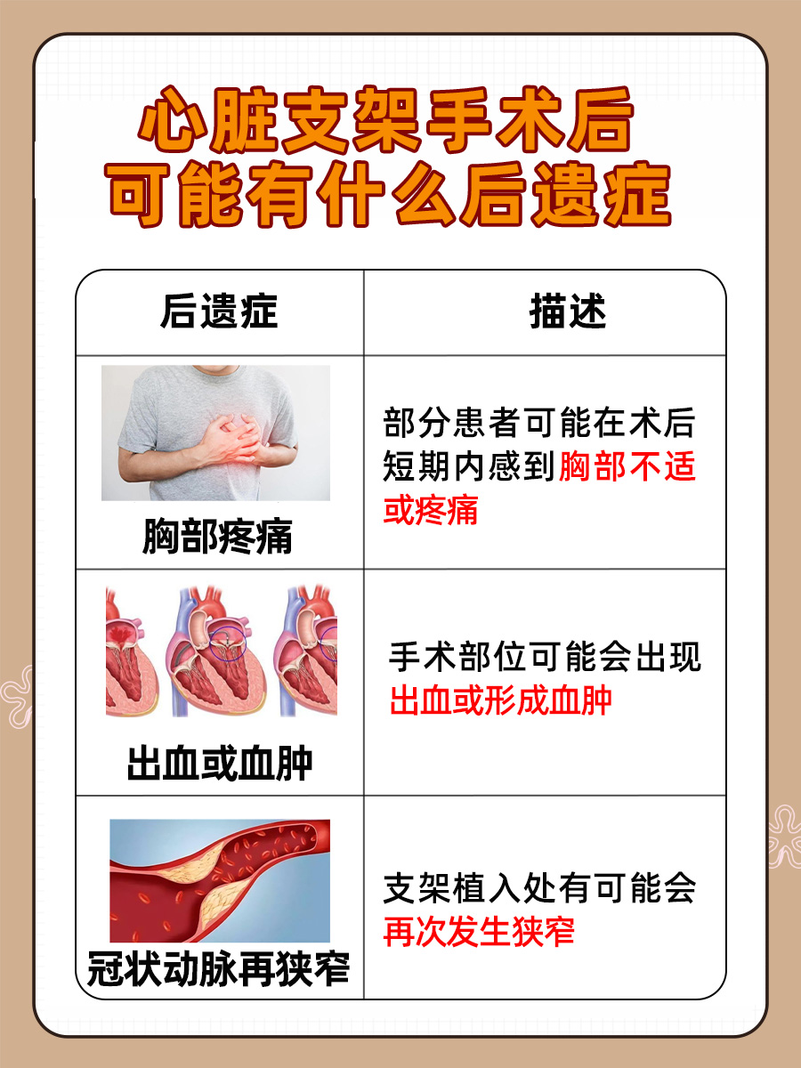 一个心脏支架多少钱？医生告诉你