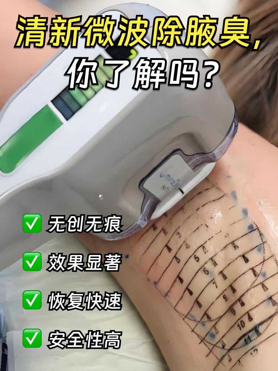 杭州清新微波祛腋臭攻略：开启清新自信生活