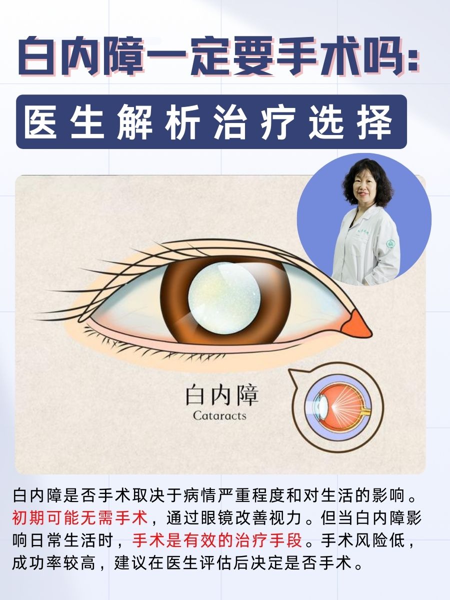 白内障一定要手术吗：医生解析治疗选择