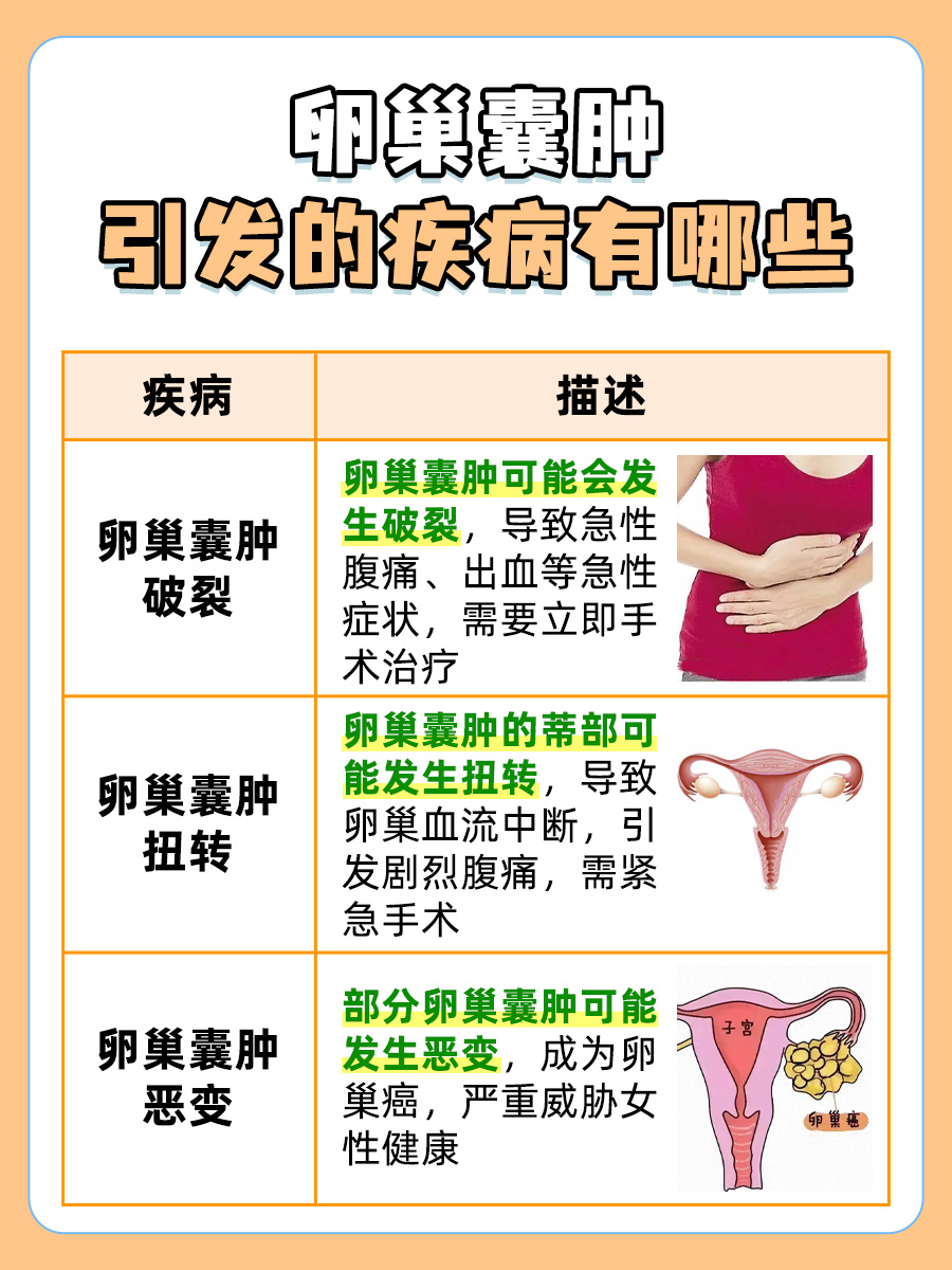 卵巢囊肿能否自愈？医生来回答你