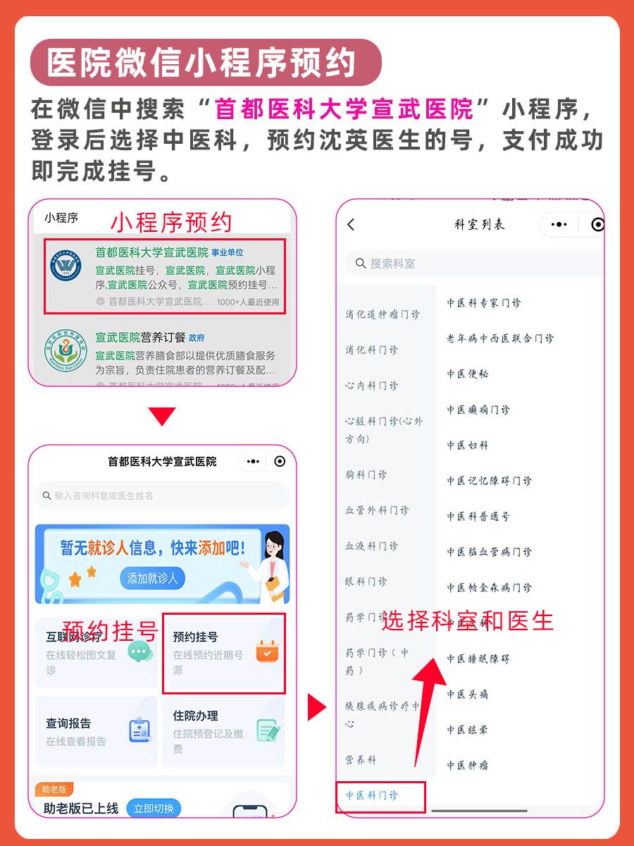 北京宣武医院沈英医生怎么样?怎么挂号?