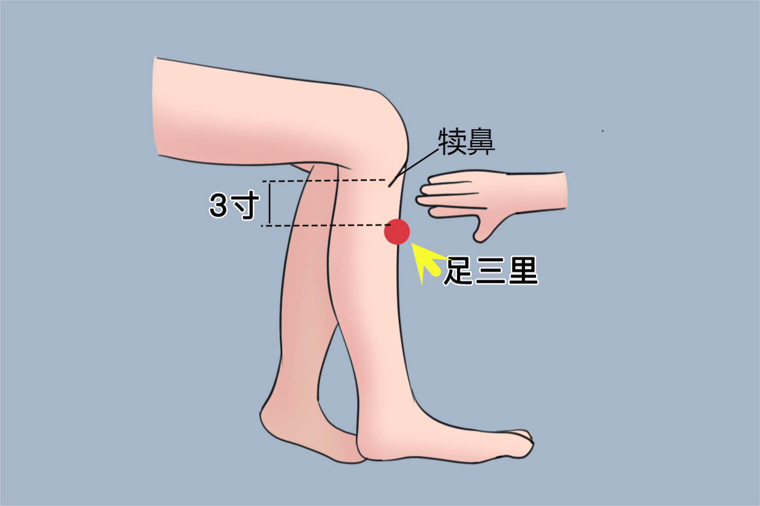 胆囊炎针灸足三里位置图 胆囊炎针灸足三里位置图