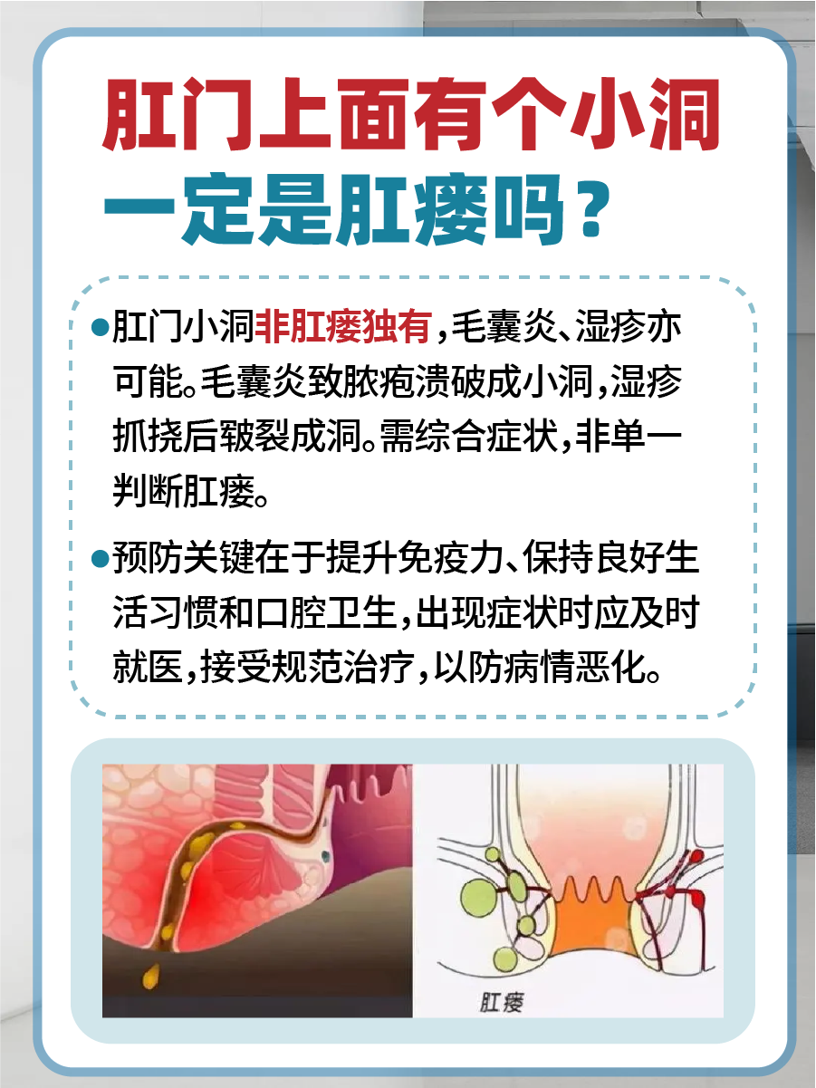 肛门上面有个小洞一定是肛瘘吗？别着急定义