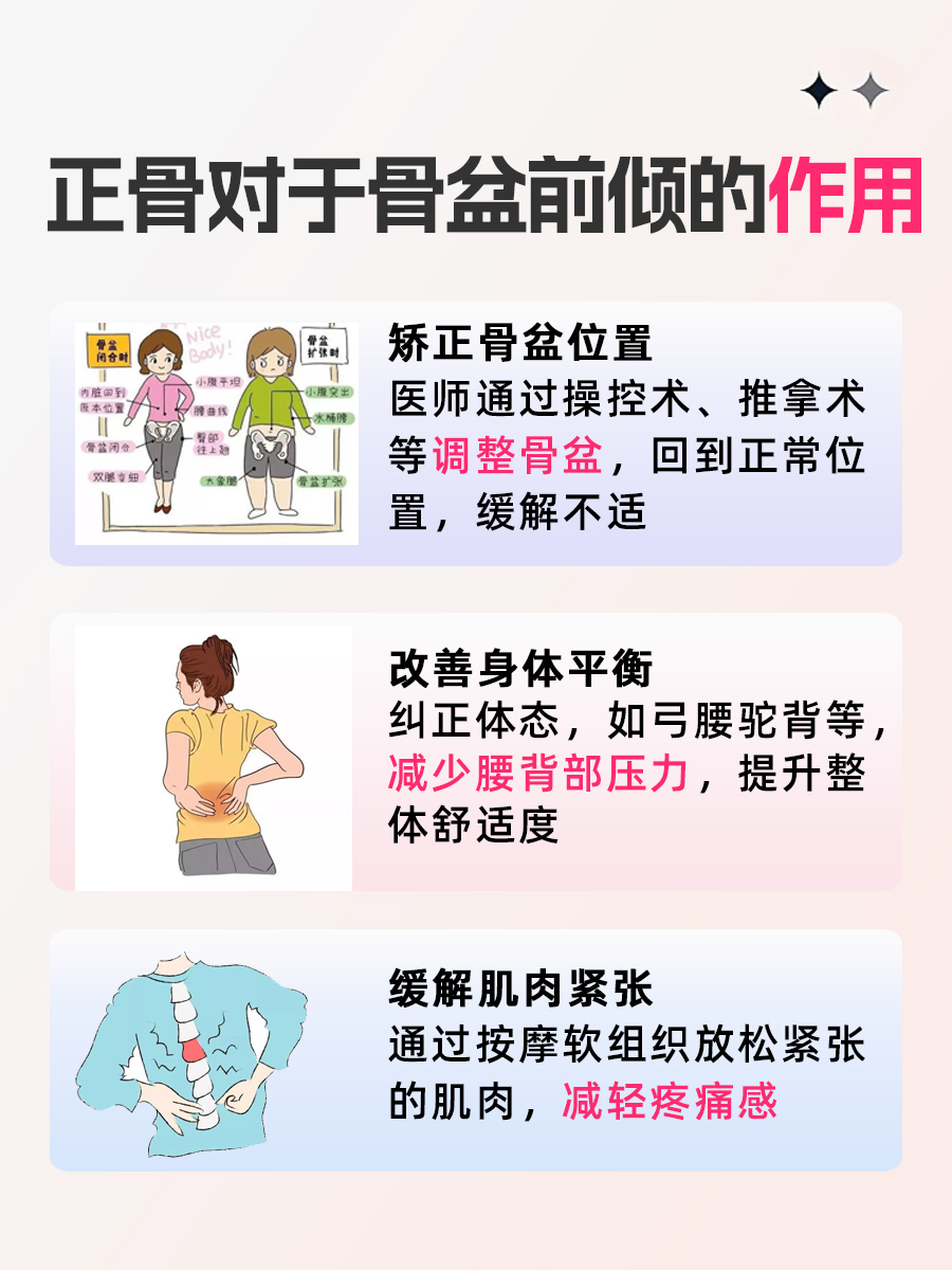 骨盆前倾，正骨疗法有效吗？
