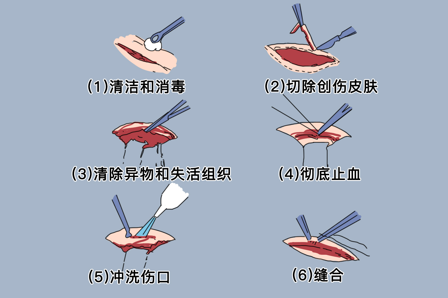 清创图