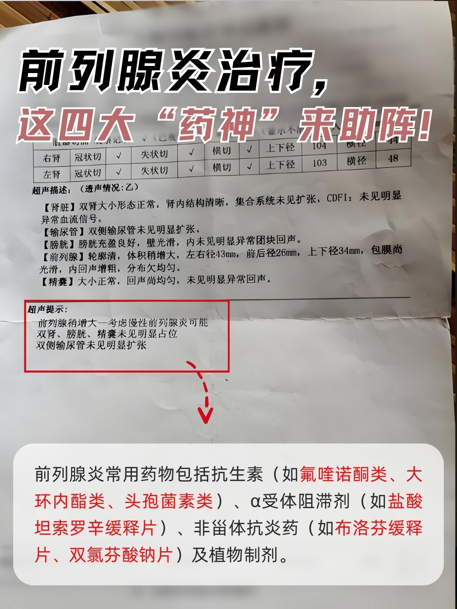前列腺炎治疗，这四大“药神”来助阵！