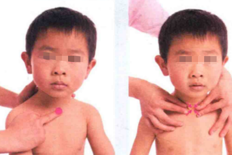 小儿天突穴位置图