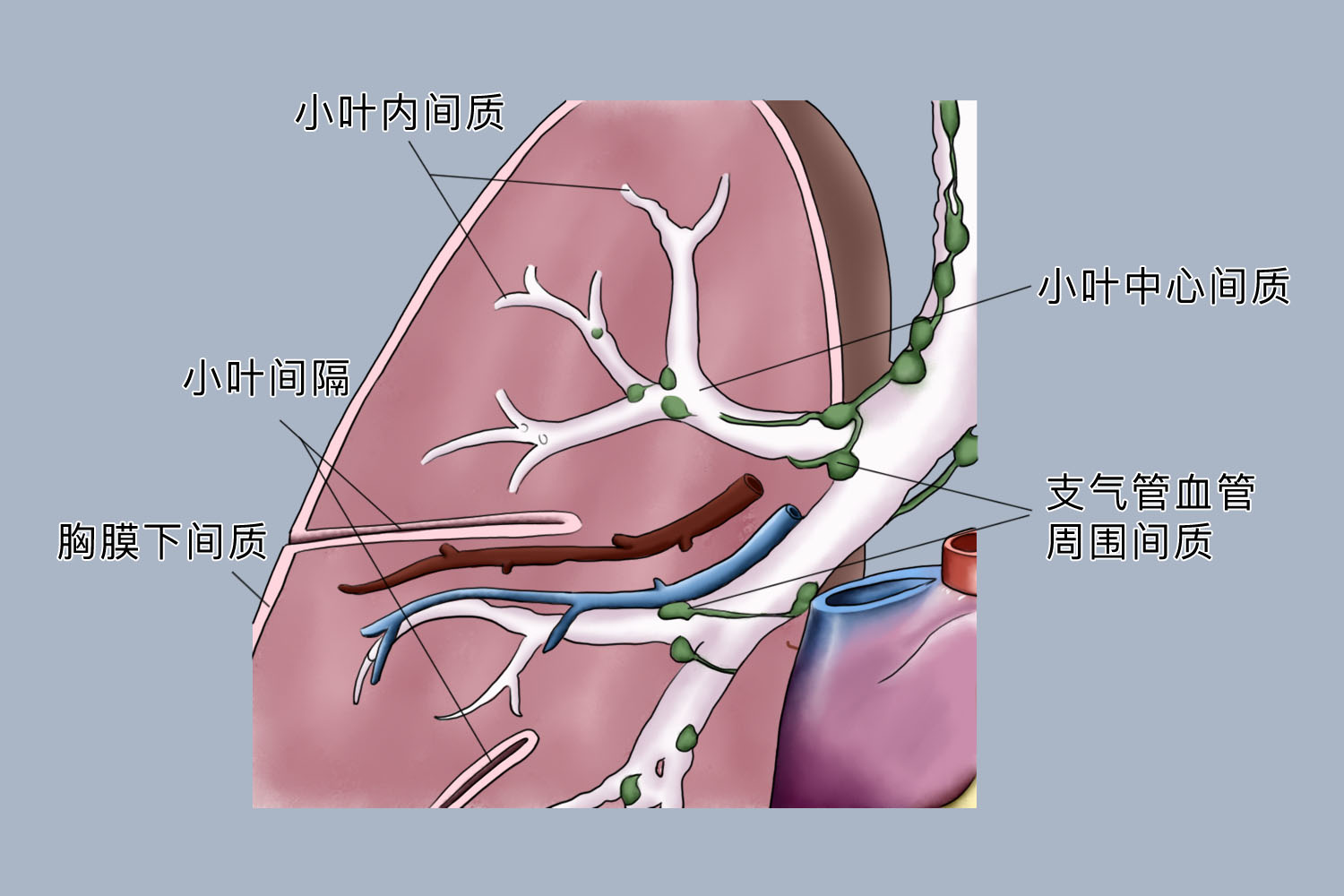 肺间质图