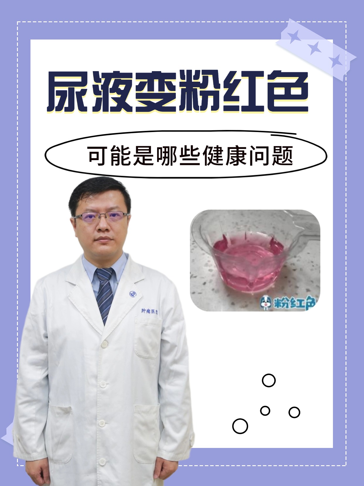 尿液变粉红色:可能是哪些健康问题