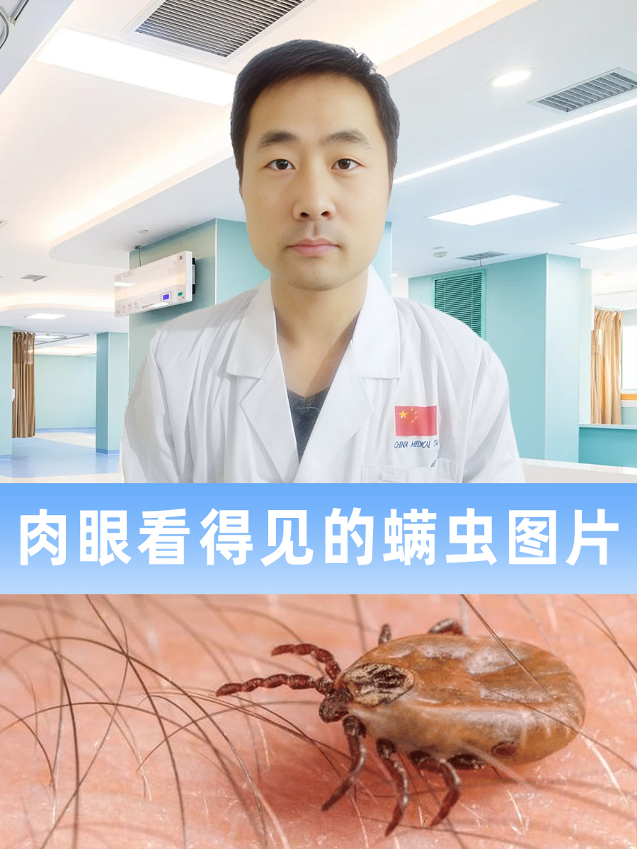 肉眼看得见的螨虫图片