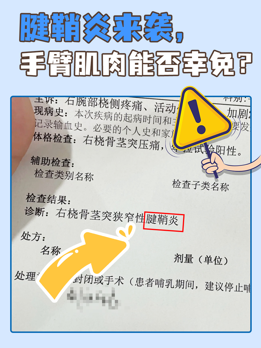 腱鞘炎来袭,手臂肌肉能否幸免?