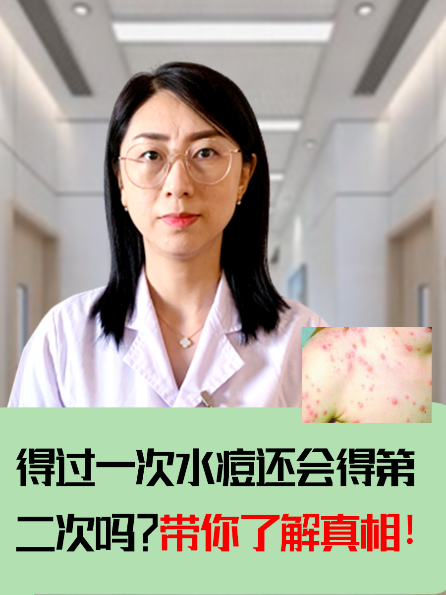 得过一次水痘还会得第二次吗？带你了解真相！
