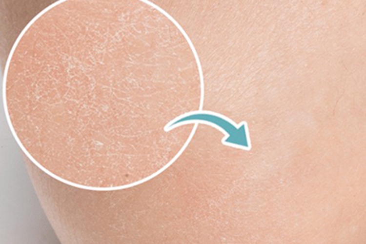 桥本甲状腺炎纹图