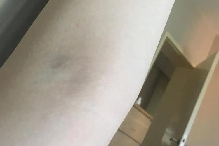 皮肤接近正常图 皮肤接近正常图