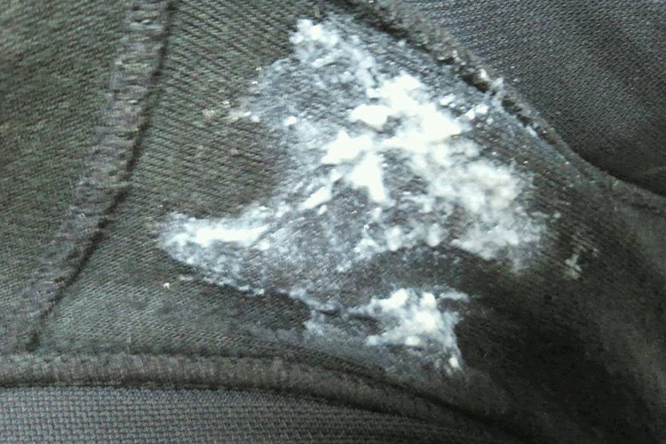 豆腐渣样白色分泌物图