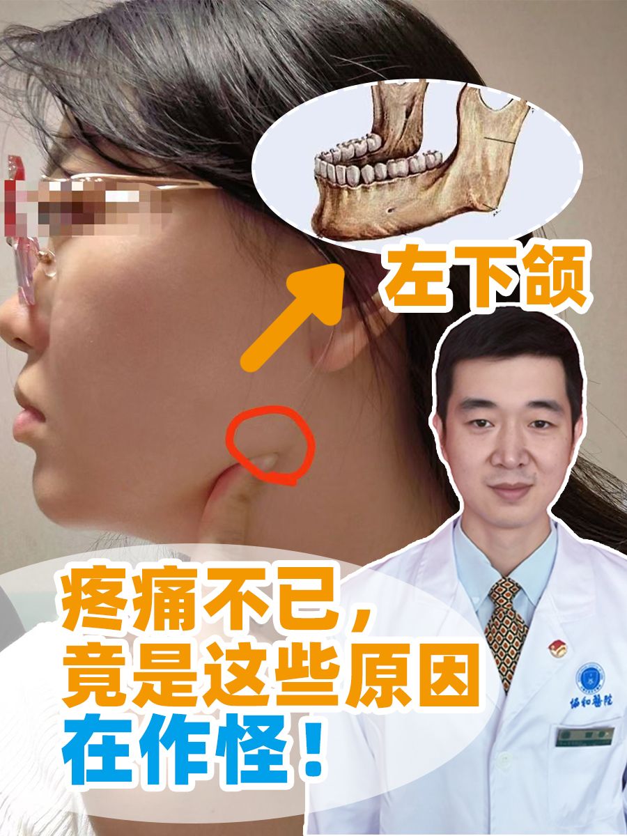左下颌疼痛不已,竟是这些原因在作怪!