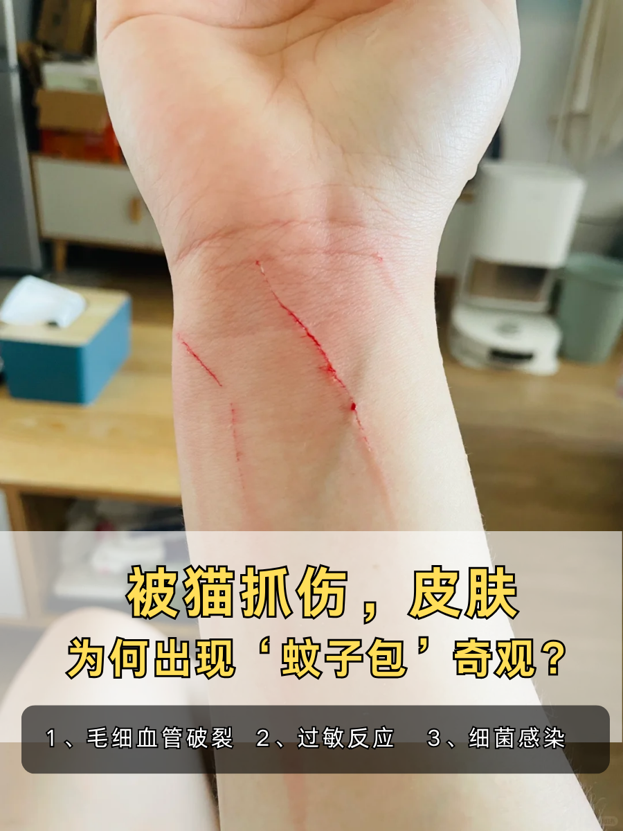 被猫抓伤，皮肤为何出现‘蚊子包’奇观？