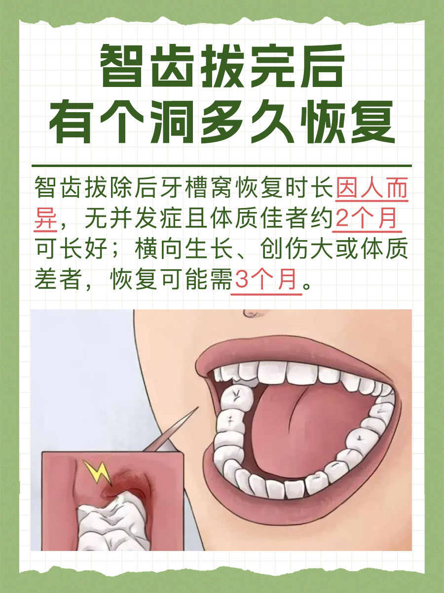 智齿拔完后有个洞多久恢复？医生解答