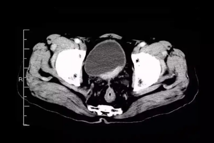 泌尿系统CT检查部位示意图 泌尿系统CT检查部位示意图