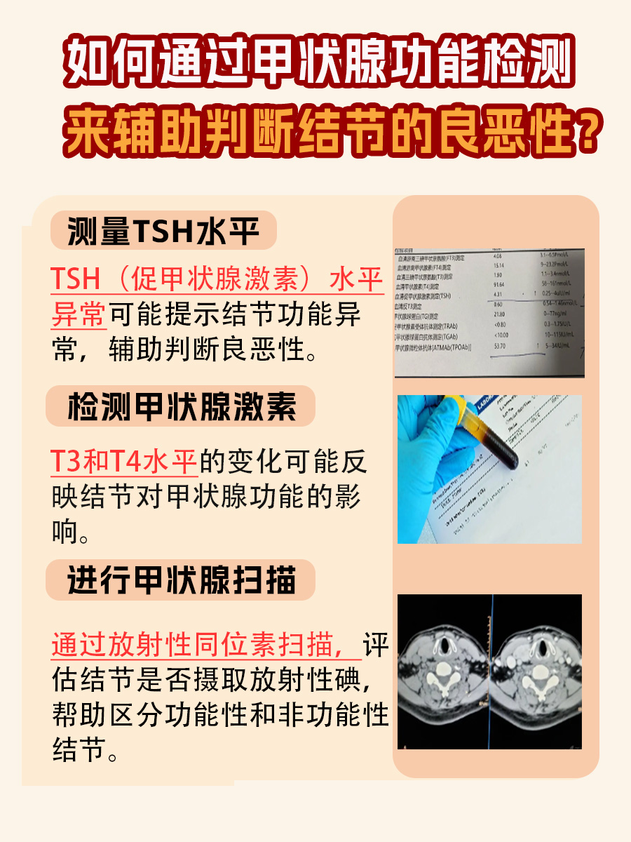 掌握5大标准，准确判断甲状腺结节良恶性！