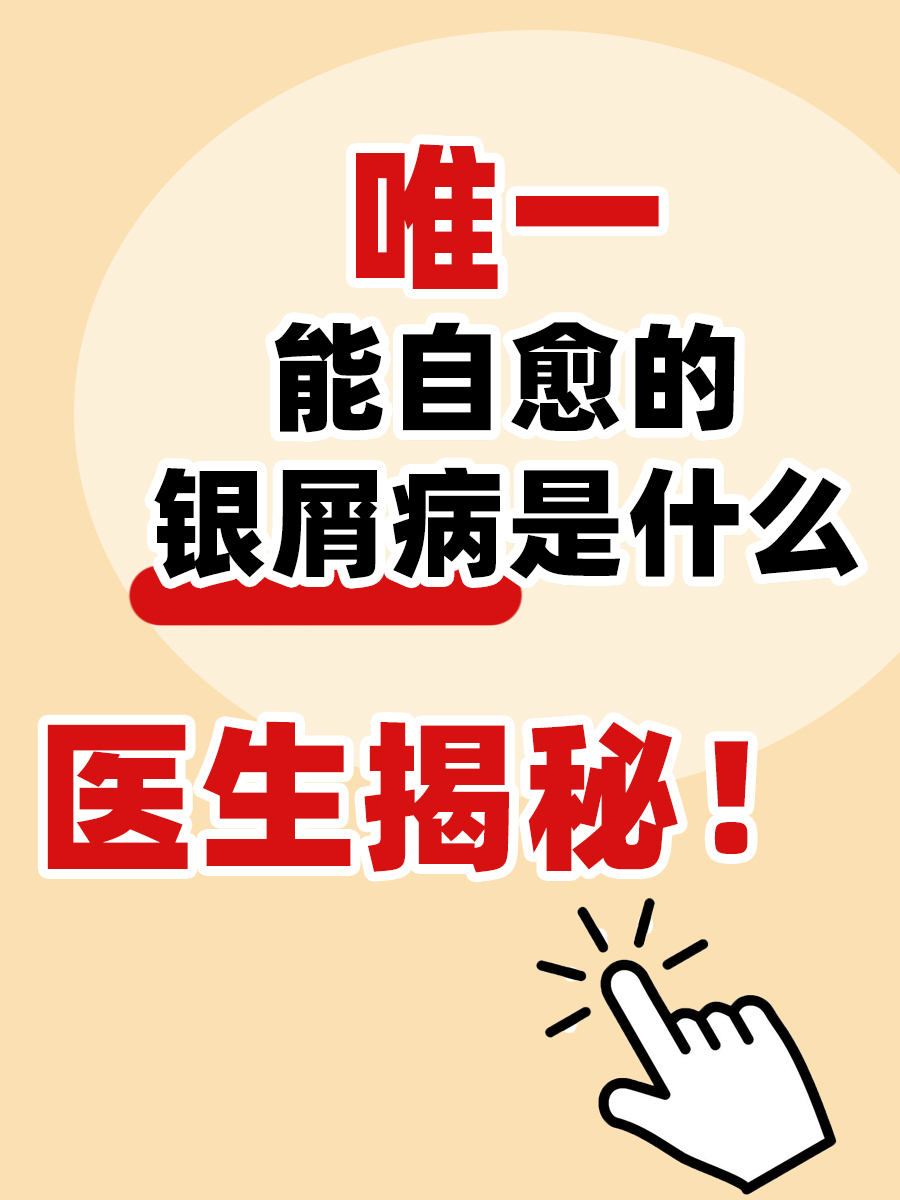 唯一能自愈的银屑病是什么｜医生揭秘！