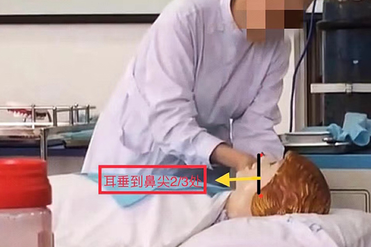 测量单侧鼻导管长度图