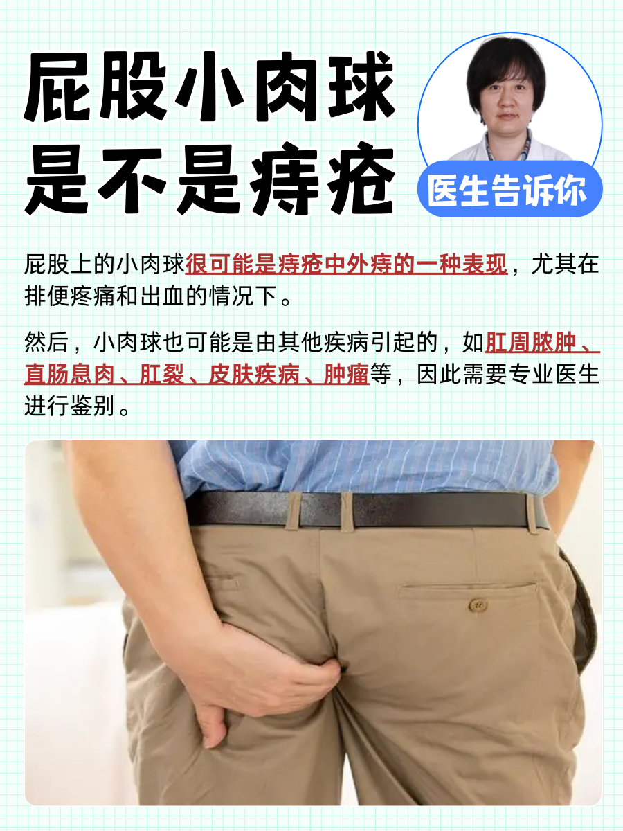 屁股小肉球是不是痔疮?医生告诉你