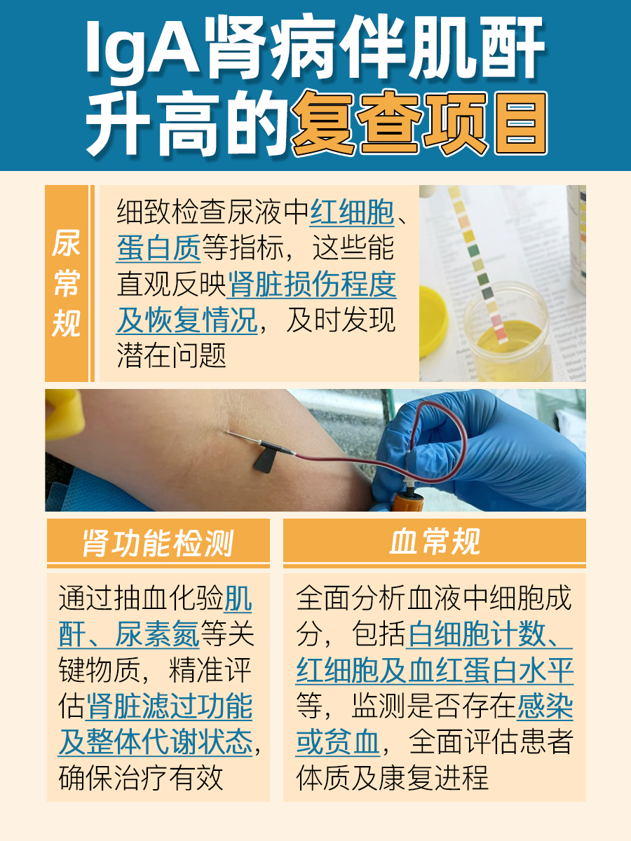 IgA肾病:肌酐上涨在哪期?必看!
