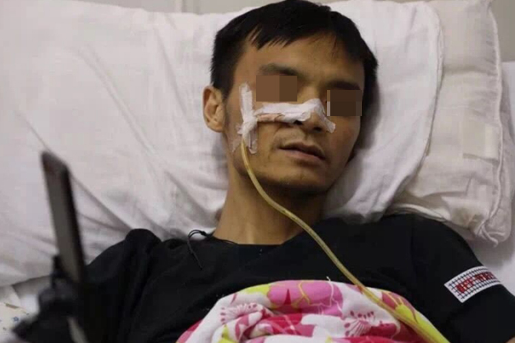 胃癌晚期患者面容消瘦、暗黄图