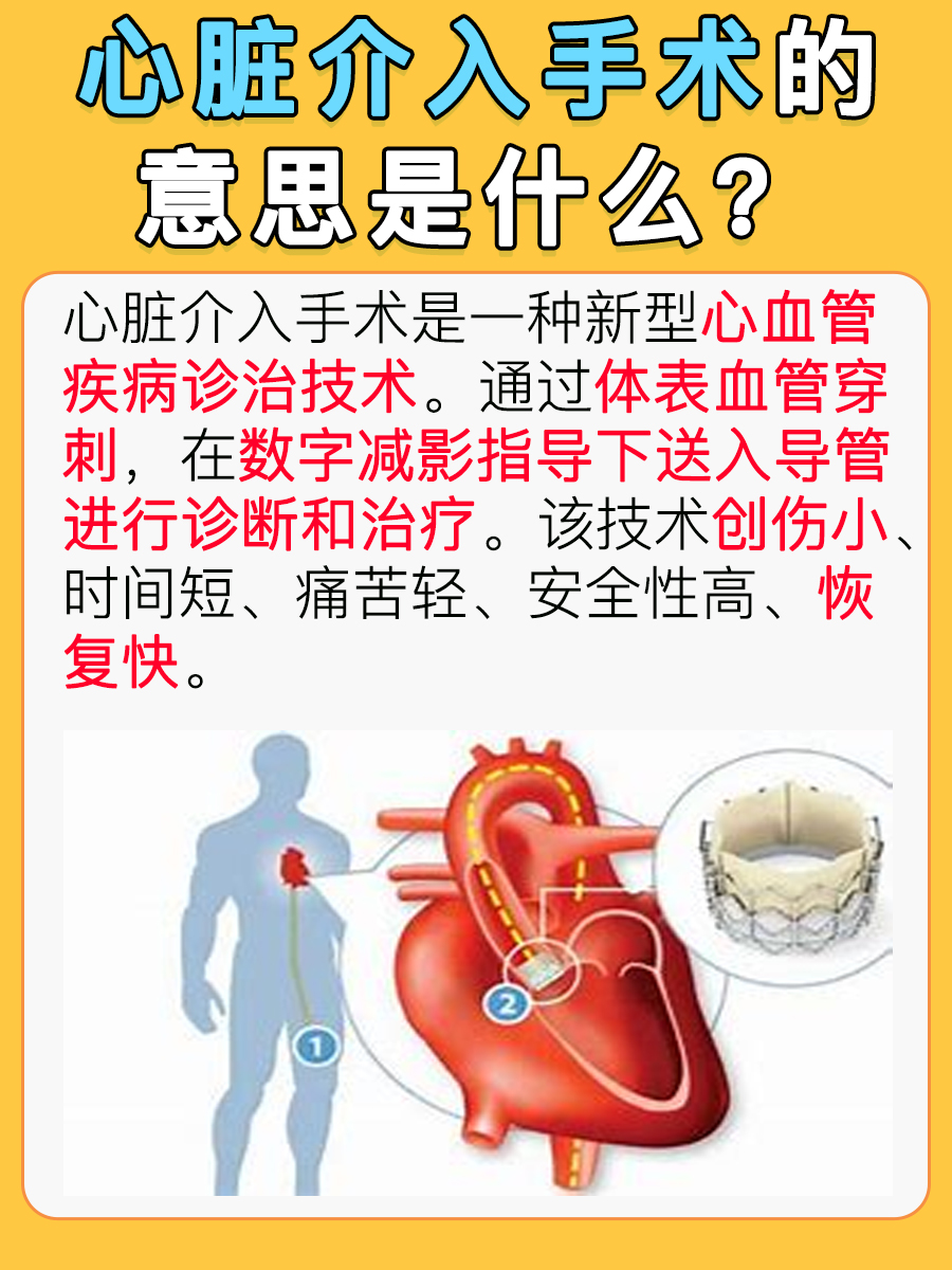 赶快了解：心脏介入手术是什么意思？